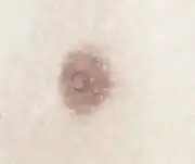 男性の乳首