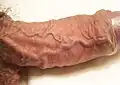 A semi erect penis with engorged dosal veins and arteries, uncircumcised