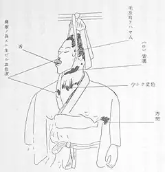 遺体上半身の拡大図(小南鑑定書付図)