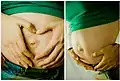 妊婦の腹部