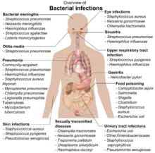 chart showing bacterial infections upon various parts of human body