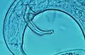 雄線虫と突起状の生殖器