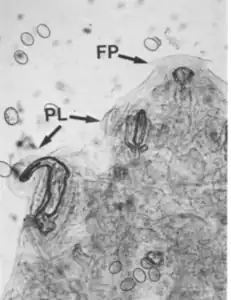 Raillietiella Teagueselfi の頭部右腹面（FP: 口、PL: 鉤）