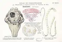 1,ヒツジ脳に形成された空洞2,嚢胞3,成体4,ウサギ前足に寄生した虫体