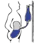 注入
