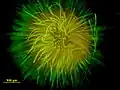 異極性糸状の Gloeotrichia
