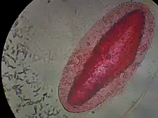 (左) 原核生物の細菌(小さな円筒形の細胞)と、(右) 単細胞の真核生物ゾウリムシの大きさを比較した顕微鏡像