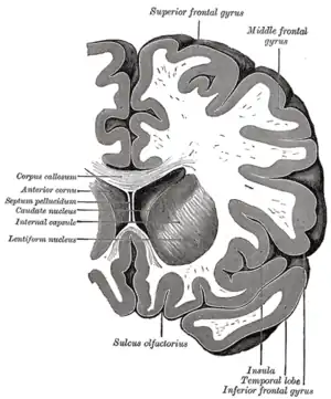 側脳室の前角での冠状断面。右の一番下に薄く見えるのが側頭葉の断面。