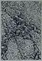 Helicobacter pylori