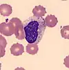 Hem1Metamyelocyte