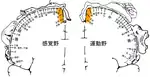 ペンフィールドの体部位局在の図に中心傍小葉の位置を重ねたもの。オレンジ色の部分が中心傍小葉に当たる。右の運動野の部分が中心傍小葉前部に、左の感覚野の部分が中心傍小葉の後部に当たる