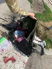 Dead body of an infant.