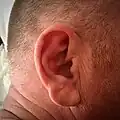 男性の右耳介