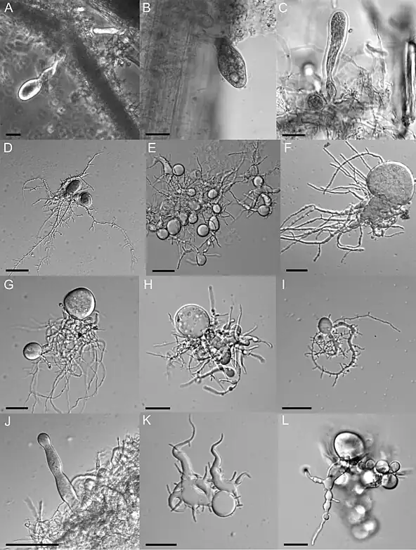 3. Liebetanzomyces polymorphus の菌体: 遊走子嚢と発達した仮根からなる分実単心性の菌体。スケールバーは 20マイクロメートル