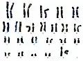 正常女性核型（性染色体XX）