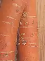 ネコブセンチュウの被害を受けたニンジン