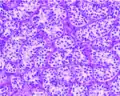 セルトリ細胞腫の高倍率顕微鏡写真：セルトリ細胞細管が確認出来る。（H&E染色）