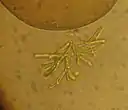 Microthamnion (トレボウクシア藻綱)