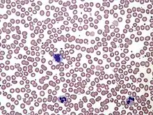 健常成人の末梢血塗抹標本（ギムザ染色）：多数のピンクの赤血球に混じって紫色の核をもつ大きな白血球や微小な血小板がみられる。