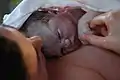 顔の皮膚が胎脂と血で覆われた出生直後の赤ちゃん