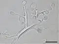 Pseudoperonospora cubensis（ツユカビ目）の胞子嚢柄