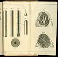 De l’auscultation médiate... 聴診器と肺の図