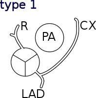 Shaher classification of TGA