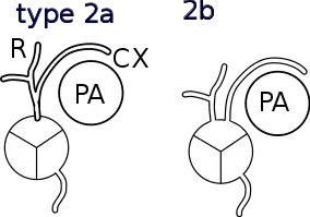 Shaher classification of TGA