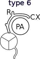 Shaher classification of TGA