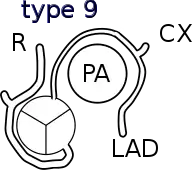 Shaher classification of TGA