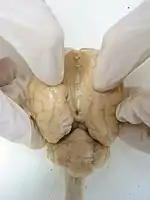 これはヒツジの脳。左右の大脳半球の間の溝(大脳縦裂)を開き、下にある脳梁を露出させている。