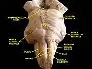 Brainstem. Anterior face.Deep dissection