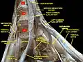 腰神経叢と仙骨神経叢 Deep dissection.Anterior view.