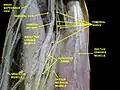 Femoral artery, deep section.