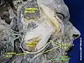 Facial artery