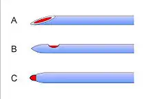 Anschliff verschiedener Spinalnadeltypen. A. Quincke (schneidend), B. Sprotte, C. Ballpen (beide atraumatisch)