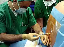 Durchführung einer Spinalanästhesie am sitzenden Patienten