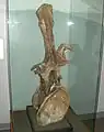 脊柱