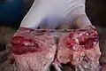 炎症を起こした、ヒツジの腸のリンパ管